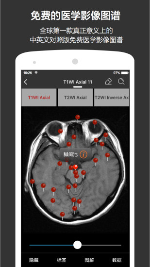 pӯt(y)W(xu) v6.5.0 ׿ 1