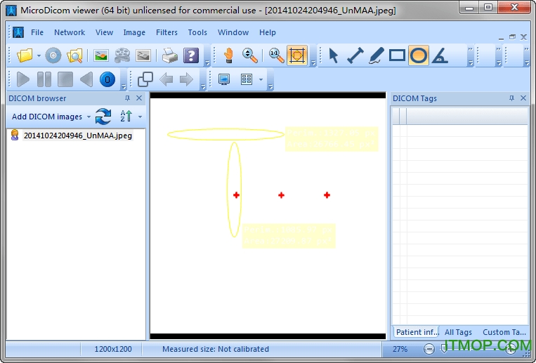 MicroDicom viewer(Dicomʽͼ) ͼ0