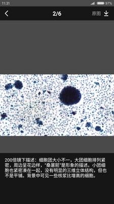 爱病理app
