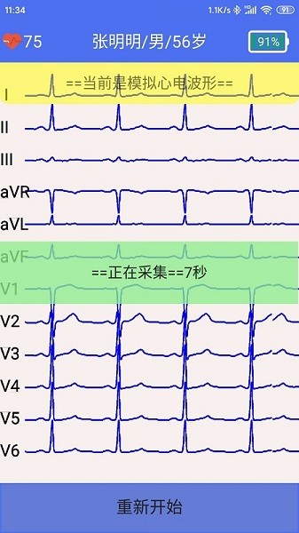 健康2030智能读图心电图系统app下载