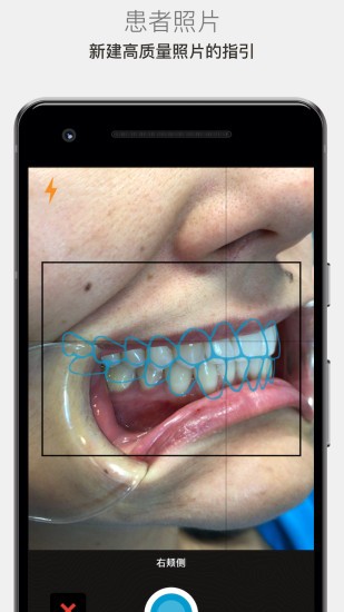 invisalign photo uploader(照片上传应用)app最新版下载 v5.4.0安卓版0