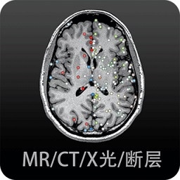 影像学图谱app最新版