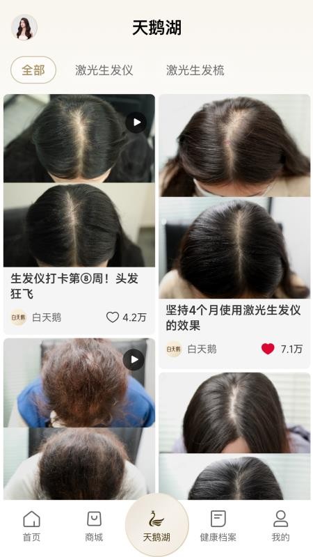 白天鹅免费版(3)