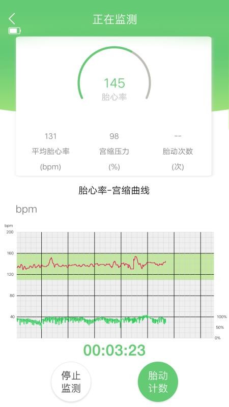喜芽胎心监护仪(5)