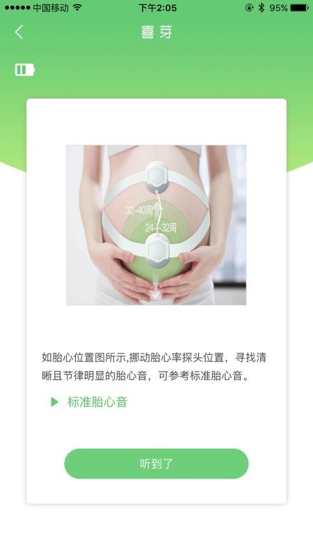 喜芽胎心监护仪(4)