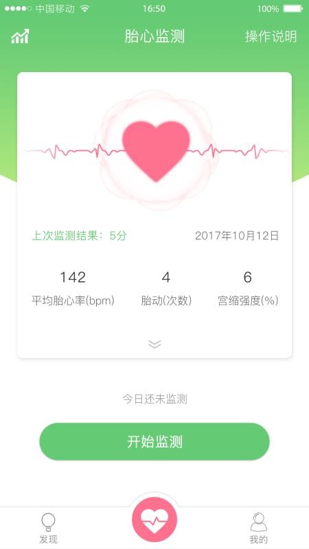 喜芽胎心监护仪(1)