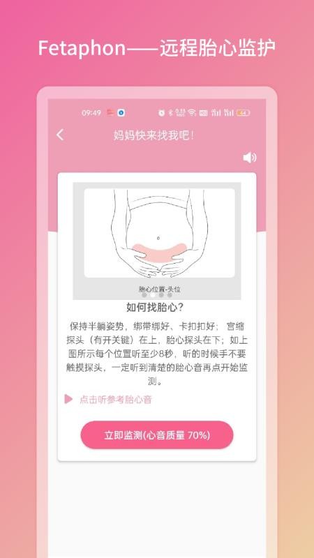 Fetaphon Home(母婴健康)v1.0.25(4)