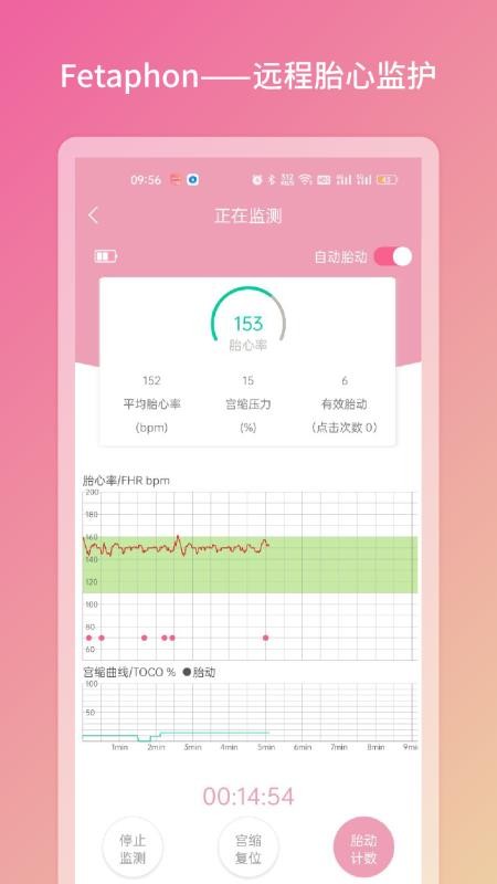 Fetaphon Home(母婴健康)v1.0.25(3)