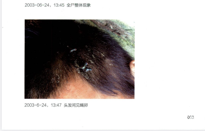 尸变图鉴：真实法医档案解密【胆小勿入】下载  4