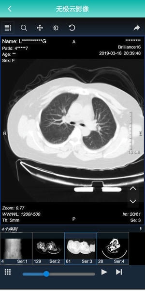 无极云影像下载 v1.0.5 2