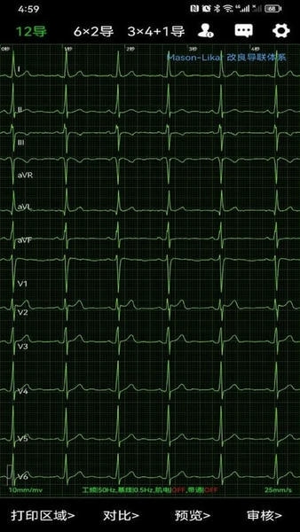 心电一张网下载 v1.0.410