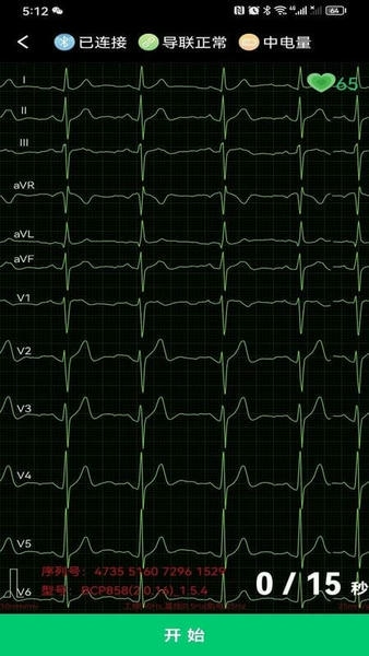 心电一张网下载 v1.0.412