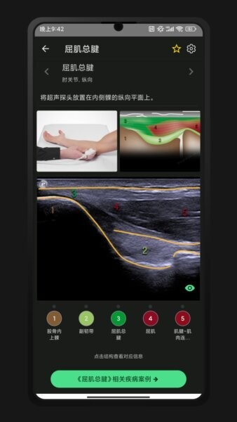 超声智学下载 v2.0.0 1